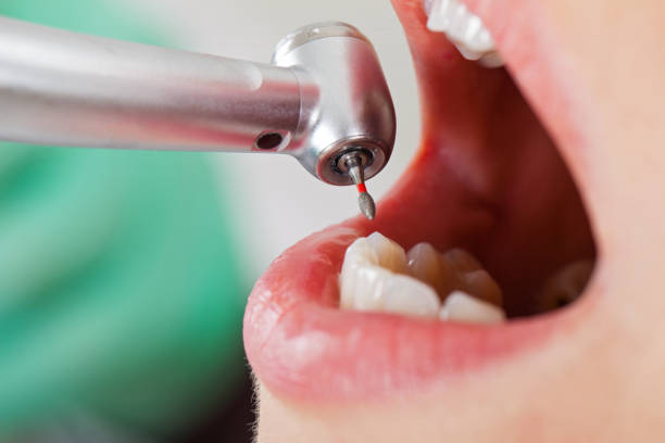 Best Emergency Cosmetic Dentistry (e.g., broken veneers) in Forney, TX